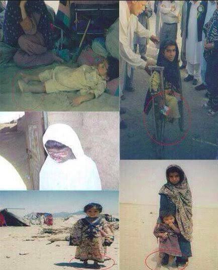 26 سال بیتگ راسکوہ مرشی داں درد ءُ گمانی تہا اِنت۔ #NukeAftermathInBalochistan #AsrokhDay #28May1998