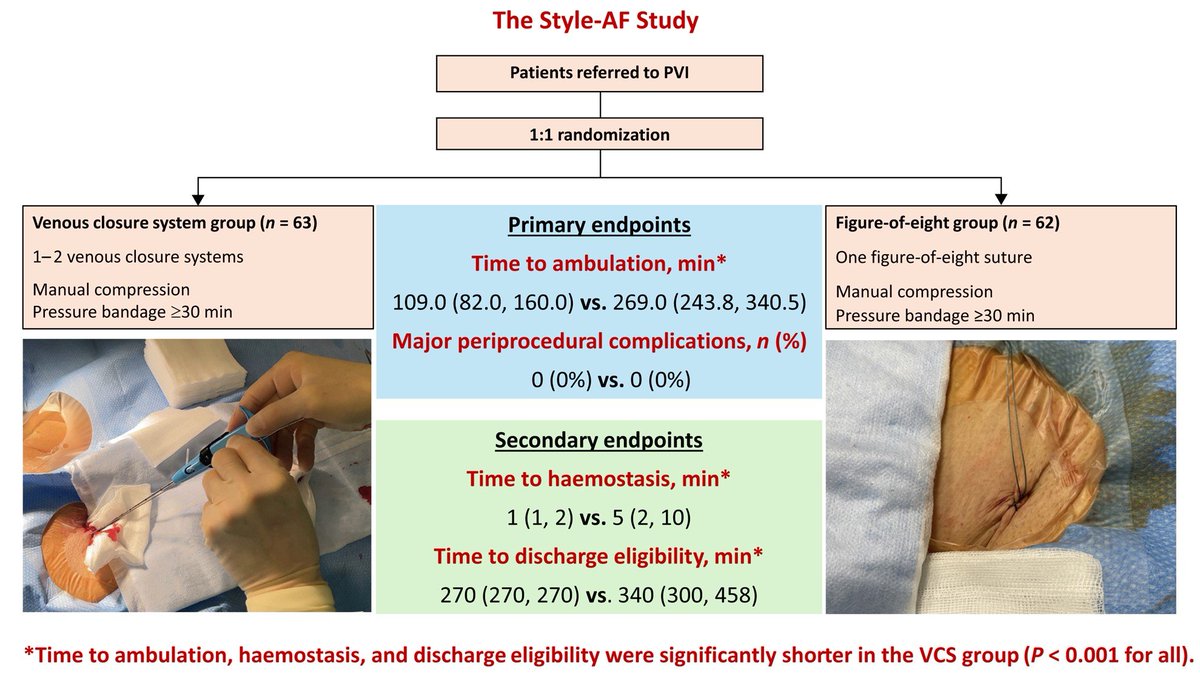 📢#Europace #Cardiotwitter #Epeeps 🤔How do you manage venous compression after AF ablation❓ Venous vascular closure system or figure-of-eight suture❓see this randomized trial❗️ 🆓👉doi.org/10.1093/europa… @GiulioConte9 @FraSantoroMD @marcovitoloMD @Dominik_Linz @AndyZhangMD
