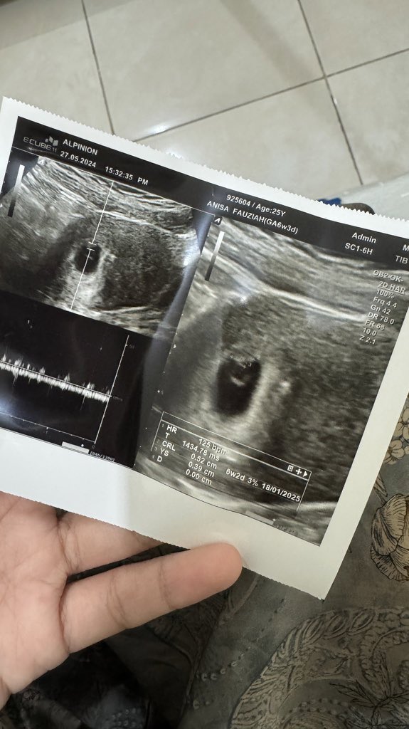 Fhaq 🌅 tweet media