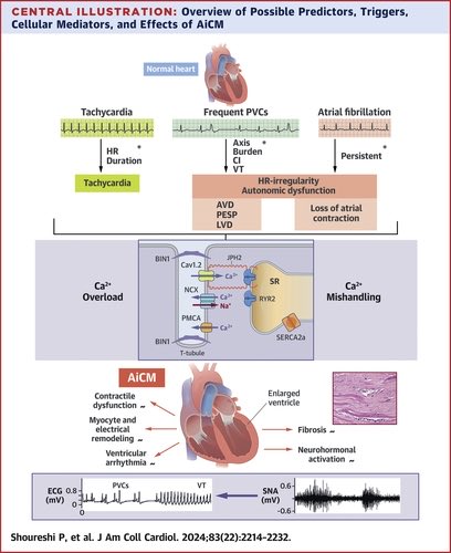 SeguraCardio's tweet photo. 📌Arrhythmia-Induced Cardiomyopathy: @JACCJournals #StateOfTheArt #Review
#Tachycardiomyopathy #epees #AIC https://t.co/WjR7t7chOI