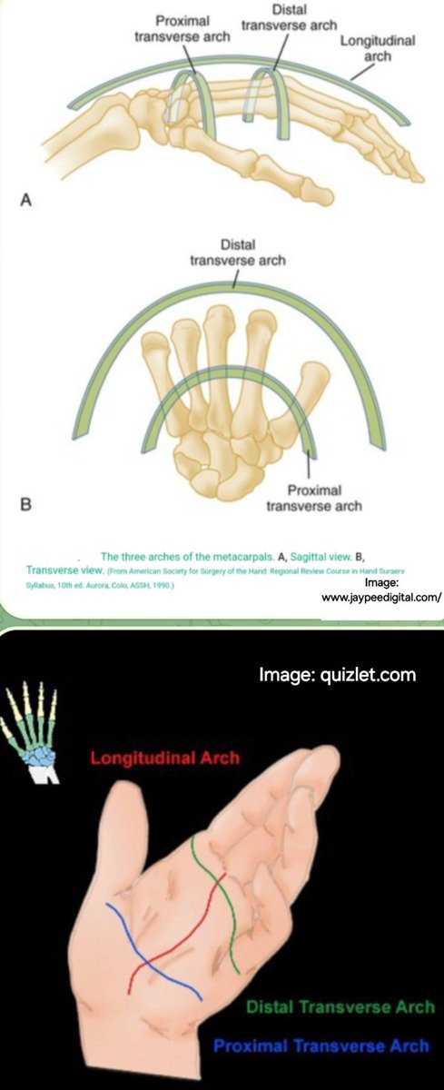 ARCHES OF THE HAND (1) Proximal Transverse keystone👉 capitate bone. (2) Longitudinal arch(s) : keystone 👉MCP joint (3) Distal Transverse : keystone👉 head of 3rd metacarpal THE ARCHES 2 & 3 ARE MOBILE,WHILE ARCHE 1 FIXED.