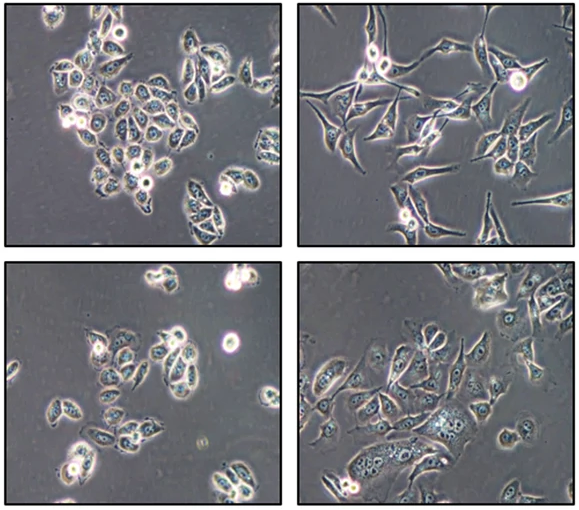 A key 🗝️ pathway underlying neuroendocrine gene 🧬 upregulation by #androgen deprivation therapy (ADT) has been revealed! Scientists showed that the EZH2-REST axis is essential for ADT-induced NE differentiation. 👉 go.nature.com/4dUOujE