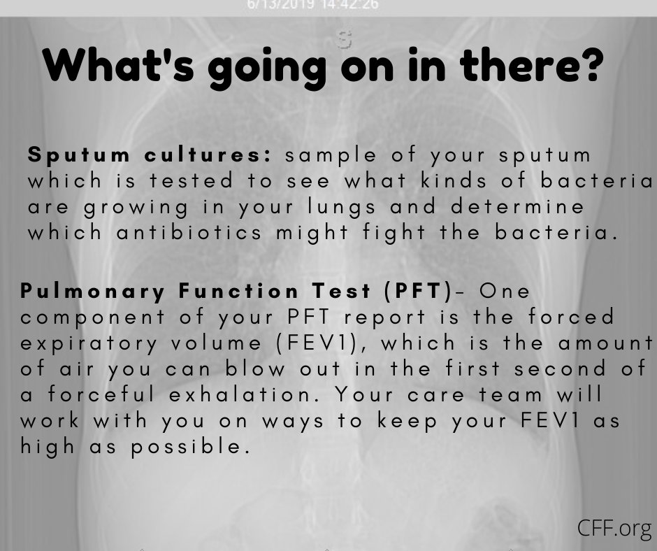 Sometimes it is necessary for someone with CF to get a lung transplant.
.
.
.
#CureCF #CF #cysticfibrosis #sixtyfiveroses #65roses #comorbidities #Support #Educate #Hope #Transplant #LungTransplant #DonateLife #OrganDonation