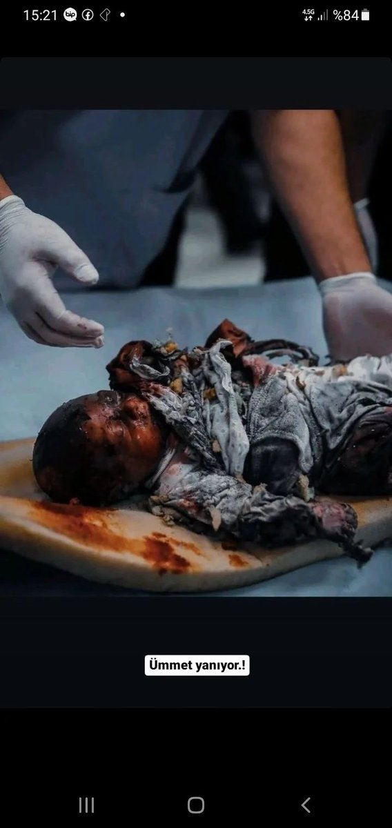 Sakine Bilgin (@sknbilgin) on Twitter photo #RafahOnFire❤🔥.... #GetoutOfRafah #StopGenocide💔 #FreePalestine🇵🇸 ... #WeWithYouGaza🇹🇷✊🏻🇵🇸 #WeWorldWithYouPaletine🌎🇵🇸..
<a href="/Israel/">Israel ישראל</a> a terörist and wild animals state 🐷🐽🤮🤬 <a href="/netanyahu/">Benjamin Netanyahu - בנימין נתניהו</a> you are terrorist and murderer 🤮 #RafahOnFire❤🔥.... #GetoutOfRafah #StopGenocide💔 #FreePalestine🇵🇸 ... #WeWithYouGaza🇹🇷✊🏻🇵🇸 #WeWorldWithYouPaletine🌎🇵🇸..
<a href="/Israel/">Israel ישראל</a> a terörist and wild animals state 🐷🐽🤮🤬 <a href="/netanyahu/">Benjamin Netanyahu - בנימין נתניהו</a> you are terrorist and murderer 🤮