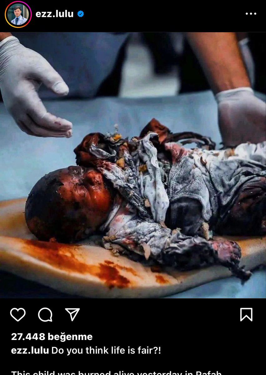 hakikatgercekte's tweet photo. @Israel_katz @RTErdogan Pislikler öldürdüğünüz bebekler bakın! Katil İsrail elbette hepiniz yargılancaksınız.Türkiye siz ahlak dersimi vermeye kalkışıyorsunuz hadsizler!!!  Hitlerden daha aşağılıksınız!Şeytandan daha şeytan #RafafOnFıre  #killerisrael https://t.co/ra74xvhkaB