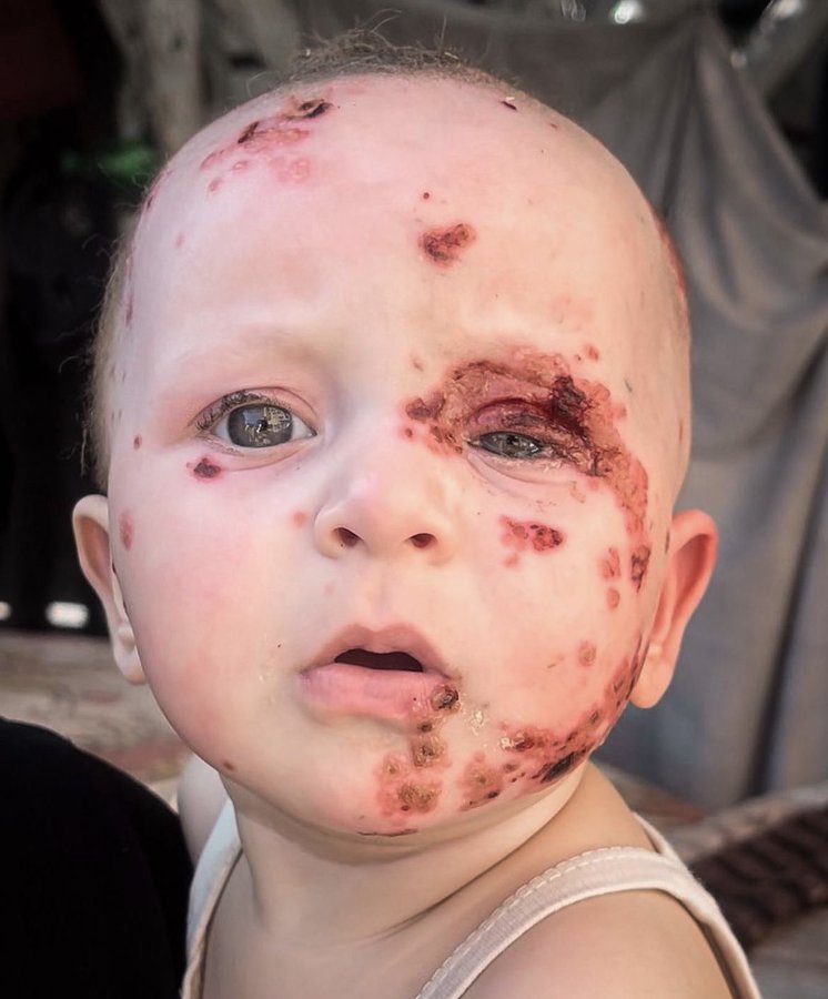 Allahımmmm, Öfkemizi, kinimizi diri tut, unutturma ve bizim elimizle olsun intikam 
#RafahOnFıre 
#RafahtaSoykırımVar