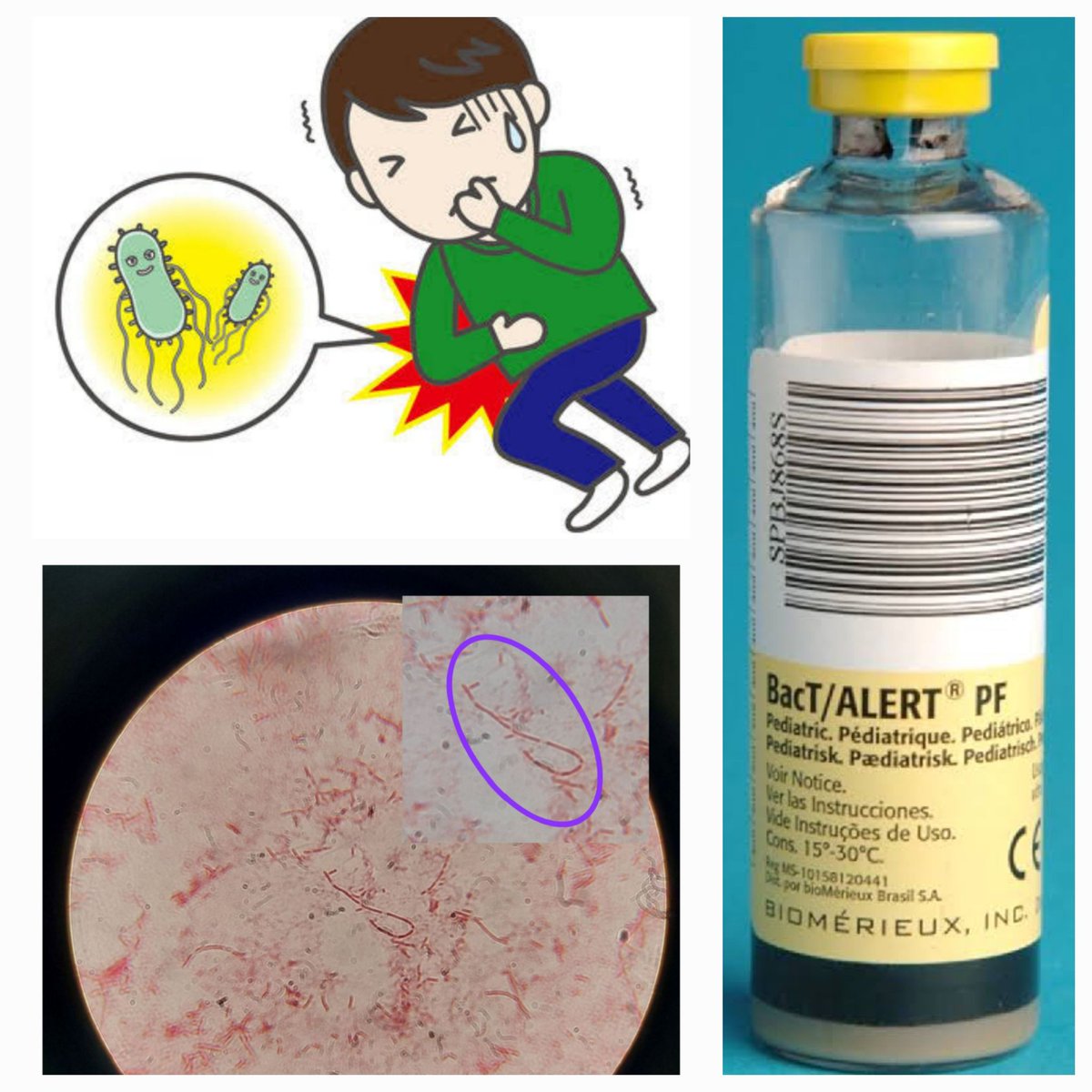 Microsthethoscope Series

Diagnosed a case of enteric fever from microbiology within 4 hours without agar plates 🧫and molecular tests🧬, read how👇

shorturl.at/EtXd4

#microsthethoscope #IDTwitter #medTwitter #clinicalmicrobiology