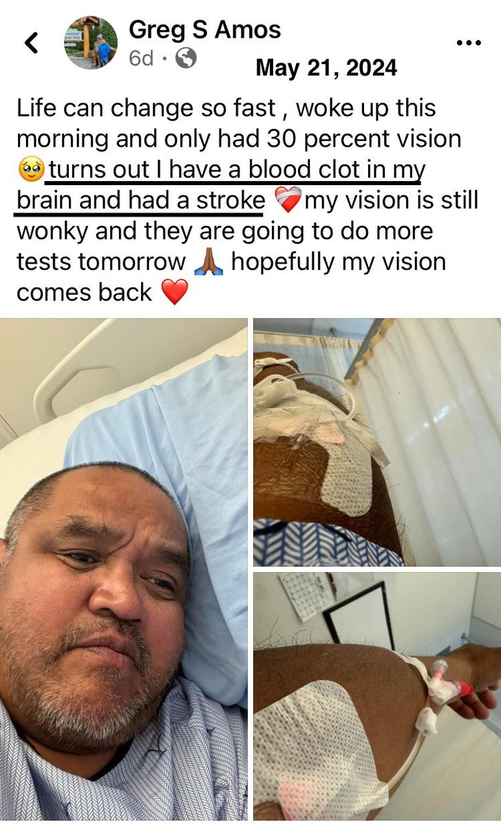 “I tested positive for Covid today… triple vaccinated so hope it doesn’t progress.”
(March 2022)

“Life can change so fast, woke up this morning and only had 30 percent vision 🥺 turns out I have a blood clot in my brain and had a stroke.”
(May 2024)

#clotshot #vaccineinjuries