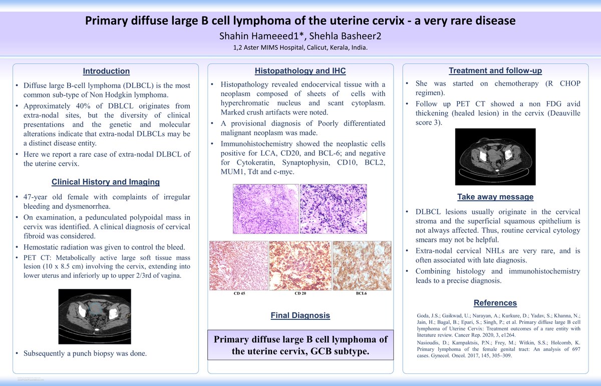 Poster Competition 2024 – Primary DLBCL of uterine cx is a rare disease. Dx can be challenging. Treatment typically involves R-CHOP chemo regimen. The prognosis is not well established, making a multi-disciplinary approach crucial. #BAGP2024