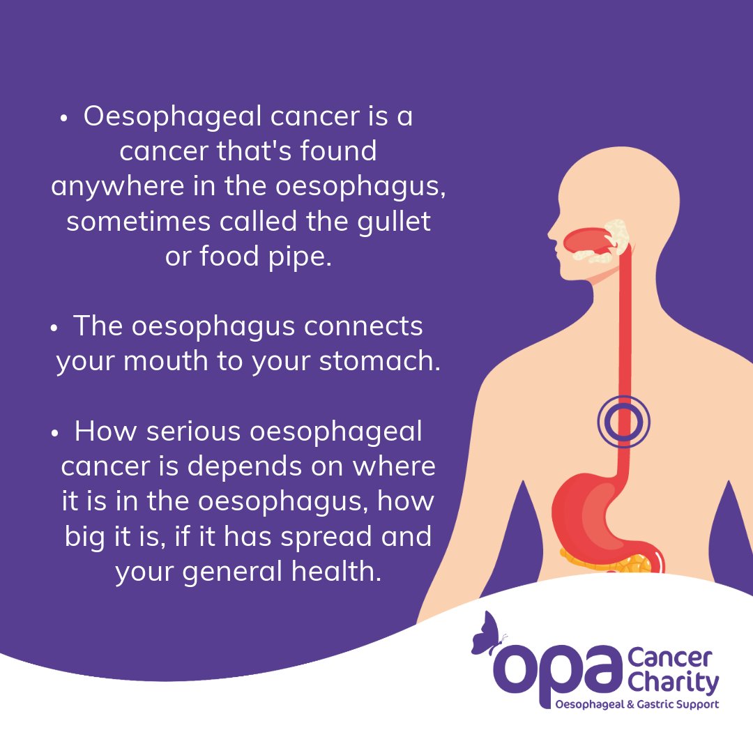 What is Oesophageal Cancer? #opa #cancer #charity #OesophagealCancer #Oesophagus #OesophagealCancerAwareness This information is extracted from NHS.