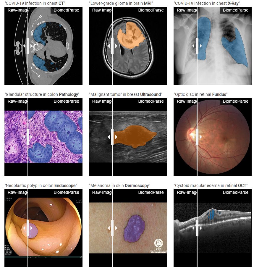 By leveraging GPT-4, it harmonizes noisy text descriptions with biomedical object ontologies for enhanced accuracy.

Trained on a vast dataset of over six million image-segmentation-text triples, BiomedParse delivers state-of-the-art performance in biomedical imaging.