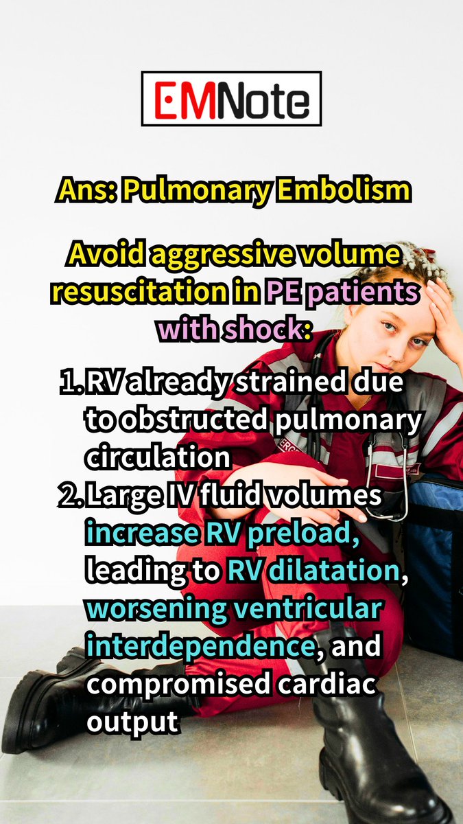 Pulmonary Embolism Avoid Fluid Challenge. youtube.com/shorts/wW9WXOM… Large volumes of intravenous fluids may further increase the RV preload, leading to RV dilatation, worsening ventricular interdependence, and compromised cardiac output.