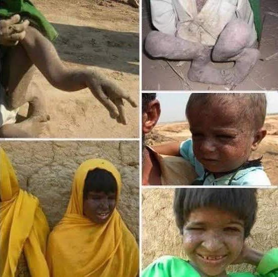 We are having a generation with deadly deceases, because they promised To Eat grass later but make atom bomb and Blast it on Baloch.
#NukeAftermathInBalochistan