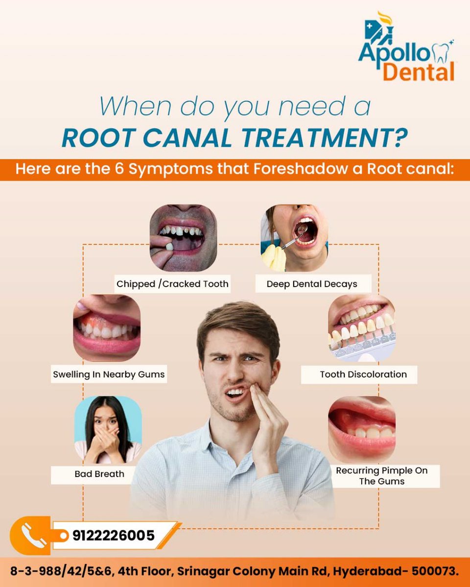 Persistent tooth pain? It might be time for a root canal treatment. Don’t ignore the signs!
For More Information
Call: 9122226005

#RootCanal #Apollodentalclinic #Srinagarcolony #DentalCare #ToothPain #OralHealth #Endodontics #DentalTreatment #ToothSensitivity #OralCare