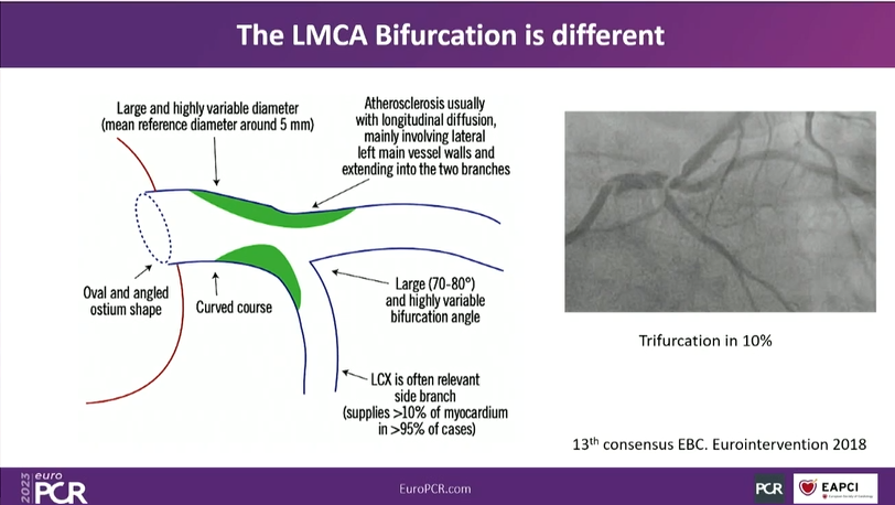 Can we use   provisional stent strategy in complex #bifurcation lesions?

📺pcronline.com/Cases-resource…

Watch this session replay to gain valuable insights  into the appropriate use of provisional stent strategies for complex  bifurcation lesions, explore optimisation techniques for