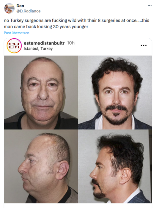 Der Zustand der Gesellschaft In meiner Timeline fand sich dieser Post. In Istanbul wurde ein Mann (links) acht kosmetischen Operationen unterzogen, um danach wesentlich jünger auszusehen (rechts). Bemerkenswert an diesem Post sind die 14 Millionen Views mit 150.000 Likes und