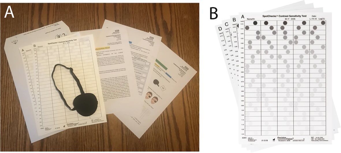 Can pen-and-paper telemedicine identify eyes most in need of #cataract surgery?  Read #OpenAccess here: nature.com/articles/s4143…
<a href="/crabblab/">Crabb Lab Research</a> #Ophthalmology #FOAMed