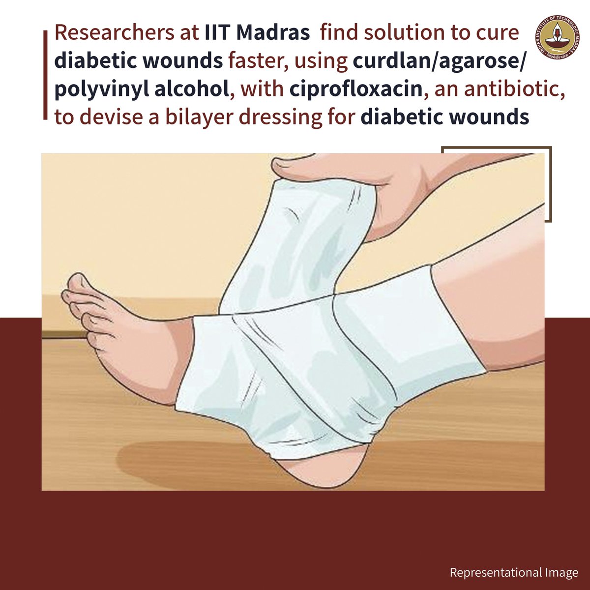 #TechTuesday Researchers at @iitmadras find solution to cure diabetic wounds faster, using curdlan/agarose/polyvinyl alcohol, with ciprofloxacin, an antibiotic, to devise a bilayer dressing for diabetic wounds. Read the full article: tech-talk.iitm.ac.in/a-diabetic-wou… #cure #diabetes