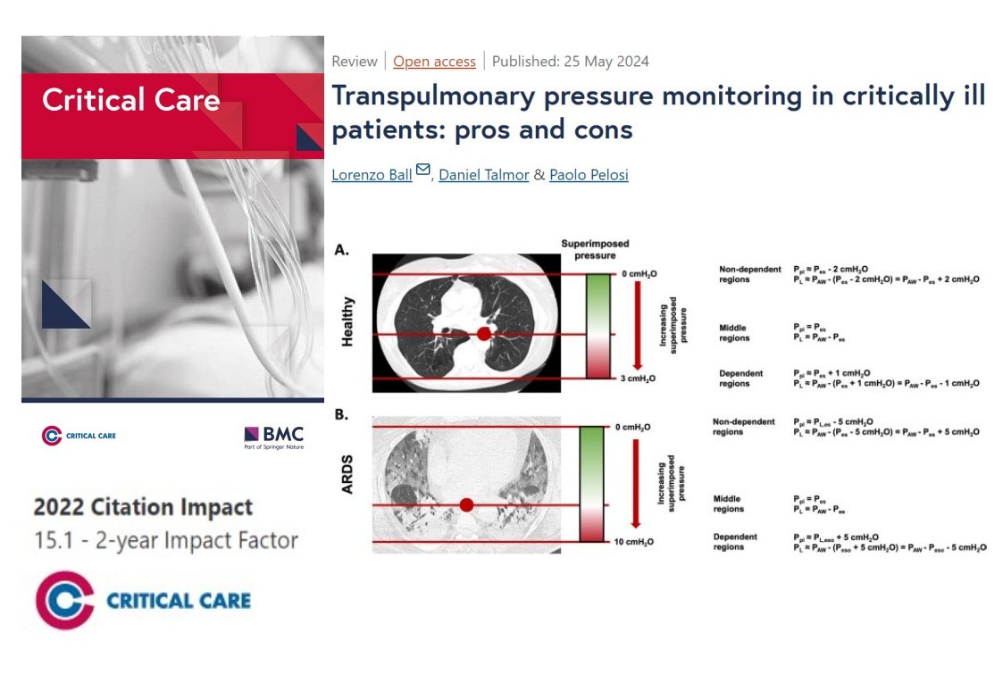 #CritCare #OpenAccess

Transpulmonary pressure monitoring in critically ill patients: pros and cons

Read the full article: ccforum.biomedcentral.com/articles/10.11…

@jlvincen @ISICEM #FOAMed #FOAMcc