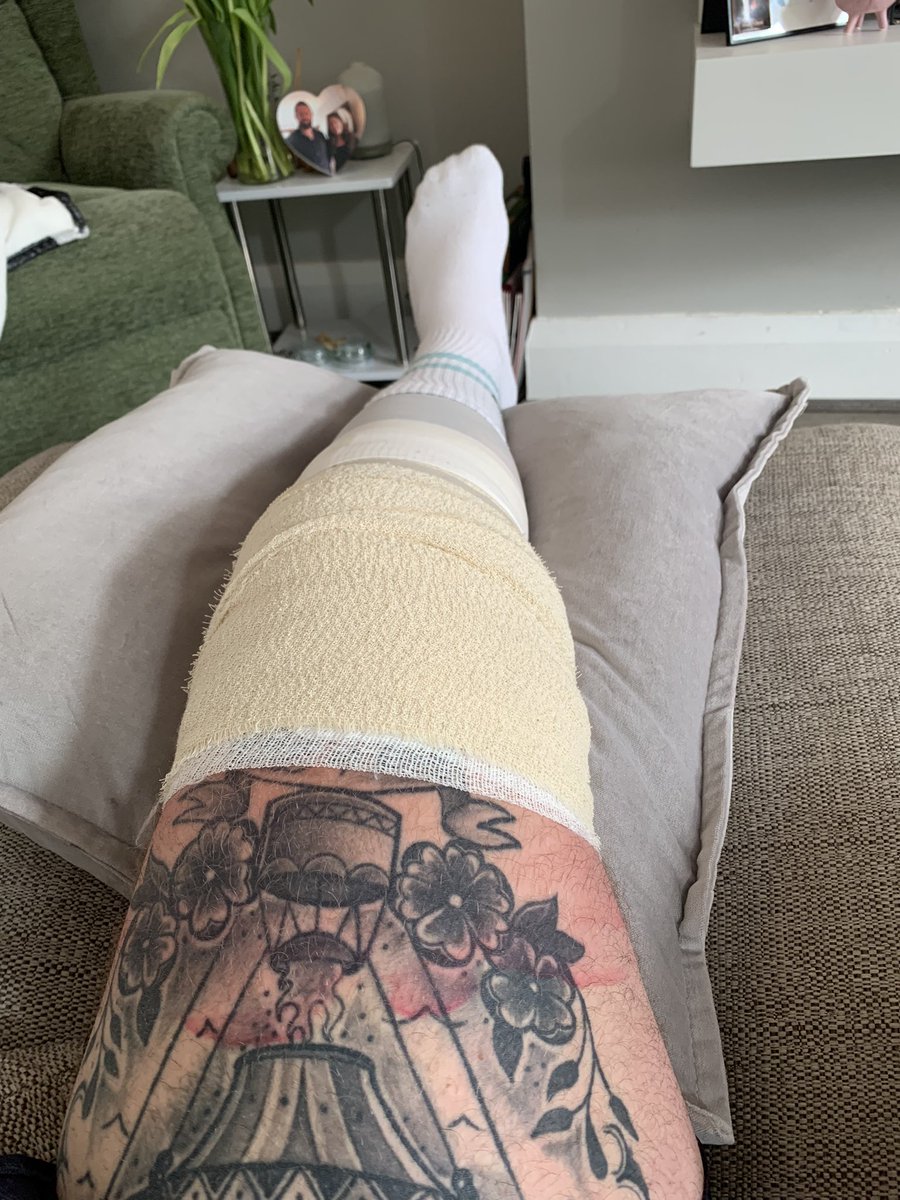 Knee operation successful ✅

Now for the hard bit, staying off my feet for a few days 😶

#roadtorecovery