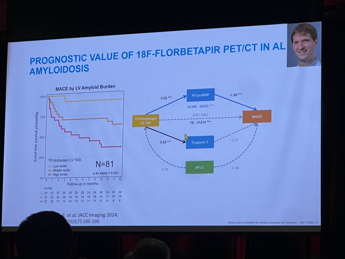 ⁦@DorbalaSharmila⁩ shares insights into new PET tracers for amyloidosis for improved diagnostic and prognostic significance. ⁦@ISA_Amyloidosis⁩ #ISA2024