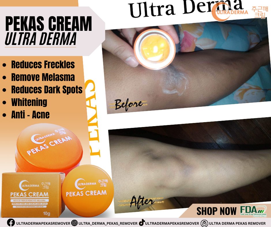 🧡🧡Ultra Derma🧡🧡
🧡🧡Pekas Cream 🧡🧡
#ultradermapekastoner
#ultradermatrio
#ultradermaduo
#ultradermatomatokojicsoap
#ultradermapekascreamremover
#ultradermapekascream
#FDAapprovedProduct
#dermatologisttested
#Skincare
#Beauty
#SkinCareRoutine
#HealthySkin
#GlowingSkin