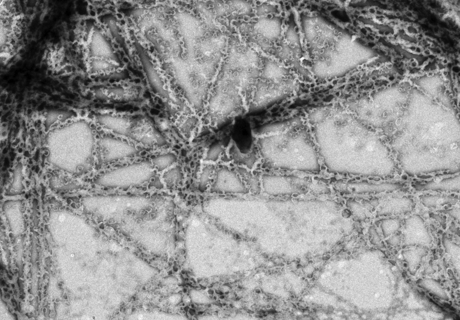 A little piece I wrote to give some context to our latest paper 🔬

Spot the difference – cells or protocells? communities.springernature.com/posts/spot-the… 

#originoflife #biomorphs #biosignatures @oolen_org @DCU_Research @DCUChemistry