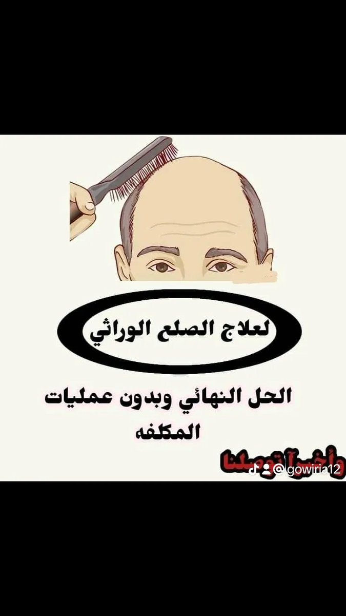 بفضل الله بدون عمليات زراعة الشعر معانا الحل الامثل للقضاء على الصلع وتساقط الشعر للاستفسار علق ب تم بعطيك الكروس الامثل🔥🔥
#ازرع_شعرك__مجانا