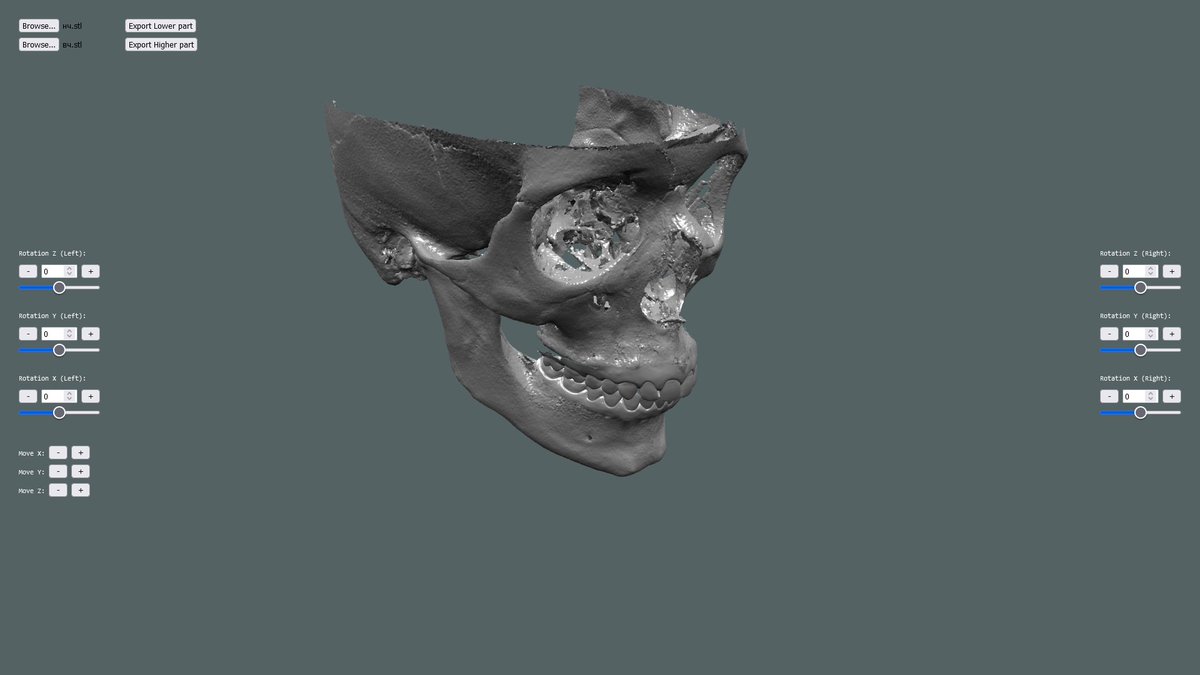 It's a medical app that i produced as UI/UX designer and 3D developer! I used #webGL <a href="/babylonjs/">Babylon.js</a> instead Three.js that popular in same medical cases  

This solution empowers medical professionals to connect MRI scull parts in 3D space with good precision.