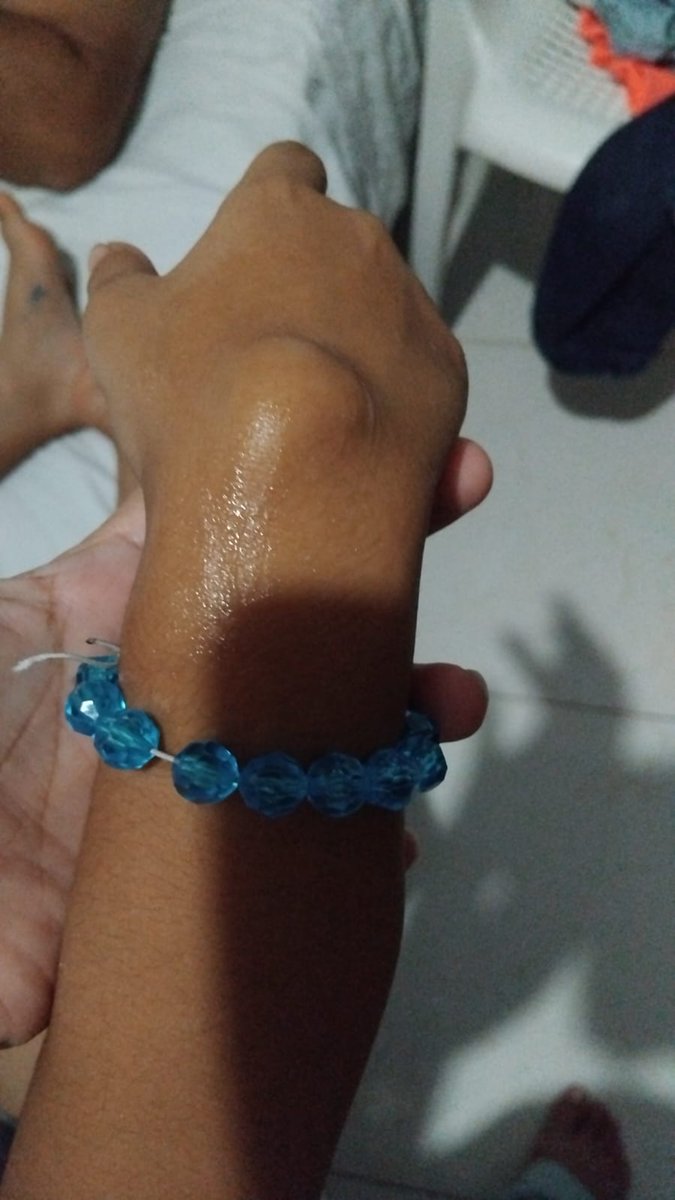 CandelariaAcuna's tweet photo. Debe crecer más para que lo operen?la clínica la Merced envió documentos @epssura para que le operen el GANGLIÓN en su mano, que no la deja agarrar ni la cuchara, por el fuerte dolor y lo que responden es que debo esperar respuesta hasta el 4 de octubre @petrogustavo @Supersalud https://t.co/8I5UpXR5dR