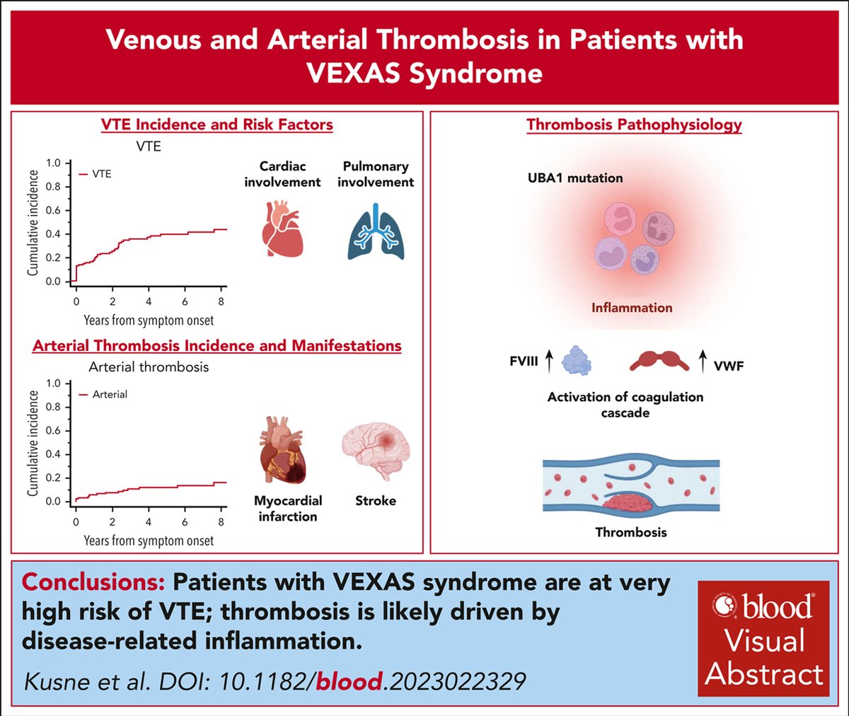 VTE is common in VEXAS syndrome, occurring in over 40% of patients with frequent recurrences; however, it is not associated with increased mortality. ow.ly/XXtA50RTHYF #thrombosisandhemostasis #clinicaltrialsandobservations #hematopoiesisandstemcells