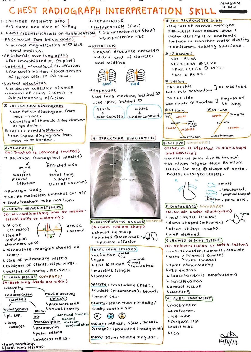 OGdukeneurosurg's tweet image. Chest Xray tips from Maryam Ulfah