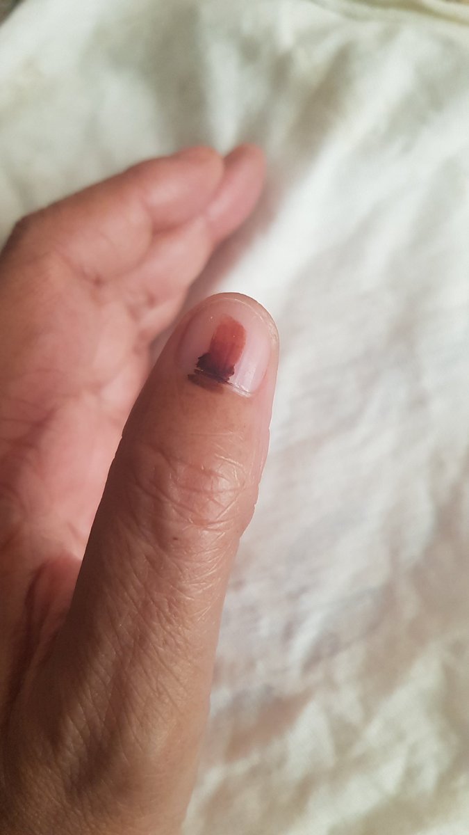 UnmovedLee's tweet photo. #IVotedEFF
#IStandWithEFF #EFFMustRise #VoteEFF
#IamVotingEFF https://t.co/30TtU8jN6y