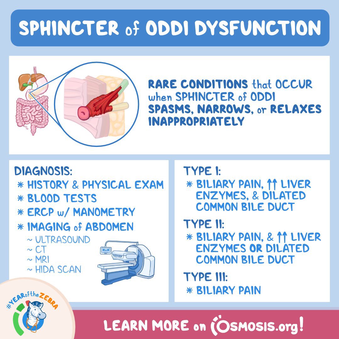 sphincter of Oddi Dysfunction @OsmosisMed #Meded #medx