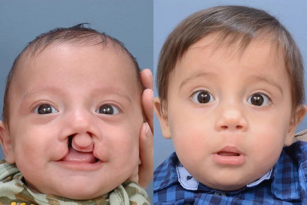 IhabFathiSulima's tweet photo. Surgery is beautiful.
And children are cute. https://t.co/HttBt1Pwmd