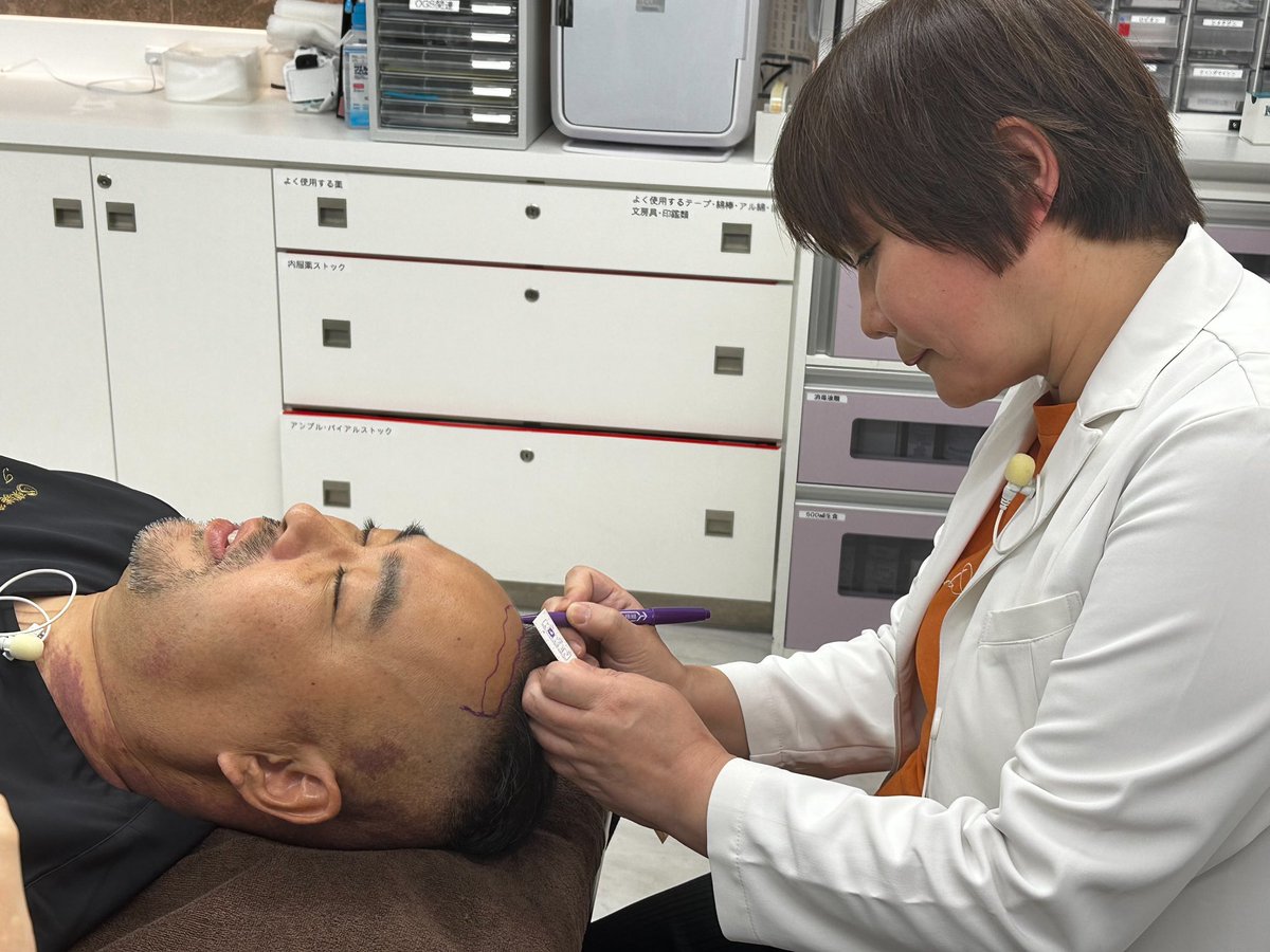 植えるよりも切除じゃね？
目から鱗よね👀
今日はいい話聞いたわ。湘南の田中永紅先生と対談。ドナー3000本は浮くな。
思いつかなかったな〜
生え際も下がるし、おでこも狭く、眉も上がるし一石二鳥。
若返りが楽しくなってきた。