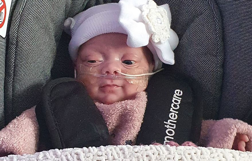 22-Week-Old Premature Baby Weighing Just One Pound Goes Home Healthy buff.ly/3eiEAsD
