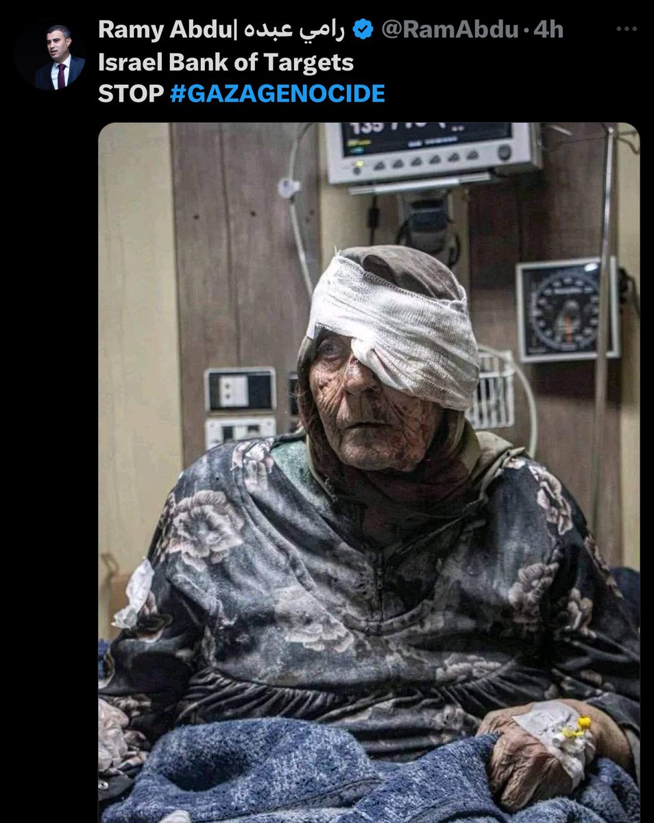 This photo is from Syria in February 2024. 

This is a SYRIAN woman bombed by ASSAD and the Russian forces months ago.