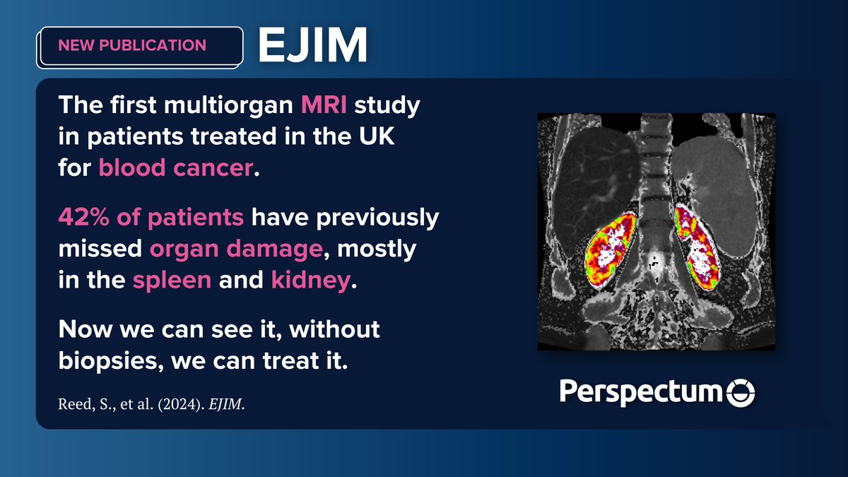 PerspectumGroup's tweet photo. Our latest study shows CoverScan detected multi-organ abnormalities in nearly half of individuals with blood cancers, and could guide personalised treatment in rare diseases. Now we can see it, without biopsies, we can treat it.

Read more: https://t.co/Oj55LfGnPN

#Bloodcancer https://t.co/2Kufc7YcKM