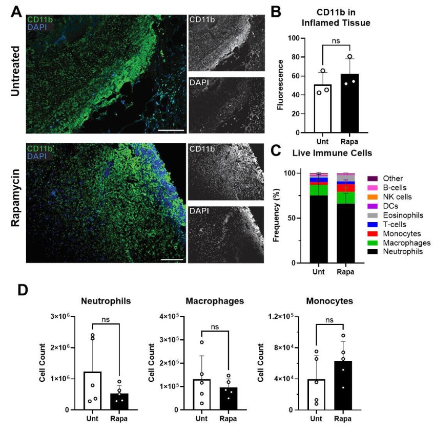 mTOR, a key metabolic regulator in mammalian cells, is required for bactericidal free radical production by phagocytes & control of Staphylococcus aureus infection. These findings in @mbiojournal have implications for the clinical use of mTOR inhibitors: asm.social/1Tj