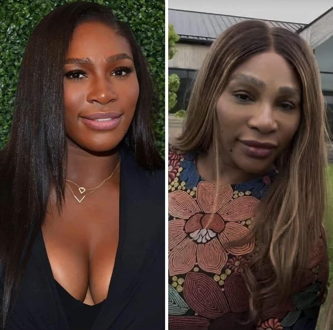 What happened to Serena Williams?