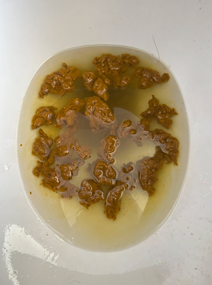 FecesLoversClub's tweet photo. SEXY Fucking popcorn feces I just pushed out a little while ago....Im backkkk 💩🔥🔥🔥🍿

Creamy as fuckkkk toilet paper smears, took big lick and tasted incredible 💩👅🧻

More feces photo coming soon 💩📸👍 https://t.co/8tX5QYCZg1