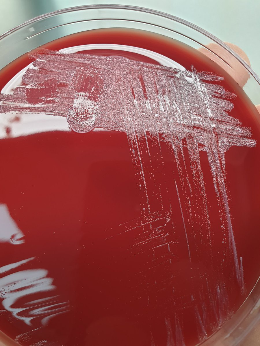 Slowly growing organism 
Gram negative coccobacilli 
Not growing on MacConkey
Catalase positive 
Oxidase positive 
Urease positive 
Mostly discovered in blood culture 
Zoonotic infection 
Causing undulant fever
Guess what?