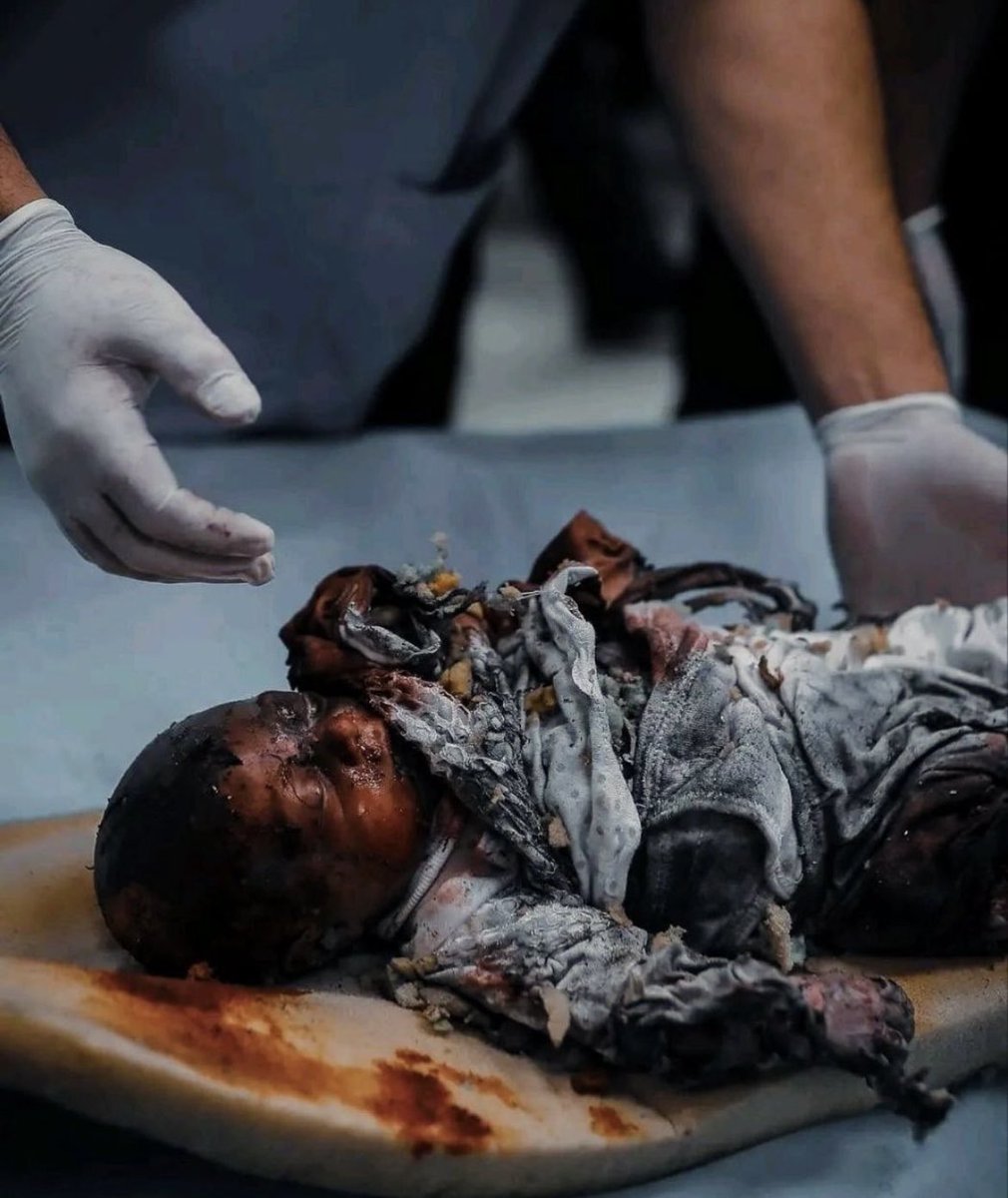 Soykırımcı israil, Refah'ta sivillerin kaldığı çadırları yine hedef aldı.
Önceki saldırıya kaza demişlerdi, bakalım bu saldırıyı hangi arkası yalan bir açıklamayla geçiştirecekler?

Soykırıma alışmayacağız!
Filistin'in sesini duyurmaktan vazgeçmeyeceğiz!

#SONDAKİKA
#RafahOnFire