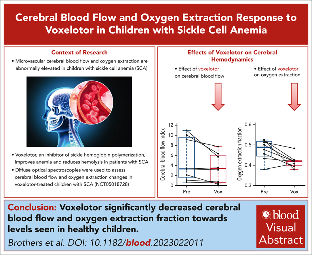 Voxelotor significantly decreases OEF and cerebral blood flow toward levels seen in healthy children. ow.ly/4gUZ50RTI3G #clinicaltrialsandobservations #pediatrichematology #redcellsironanderythropoiesis #sicklecelldisease #SCD