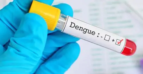 rdplanalto's tweet photo. Passo Fundo tem quase 1.700 casos de dengue neste ano; estado chega a 183 óbitos. #EuViNaPlanalto
Saiba mais ⤵

https://t.co/a38Sg1KUQl https://t.co/NlFtOAA4iy