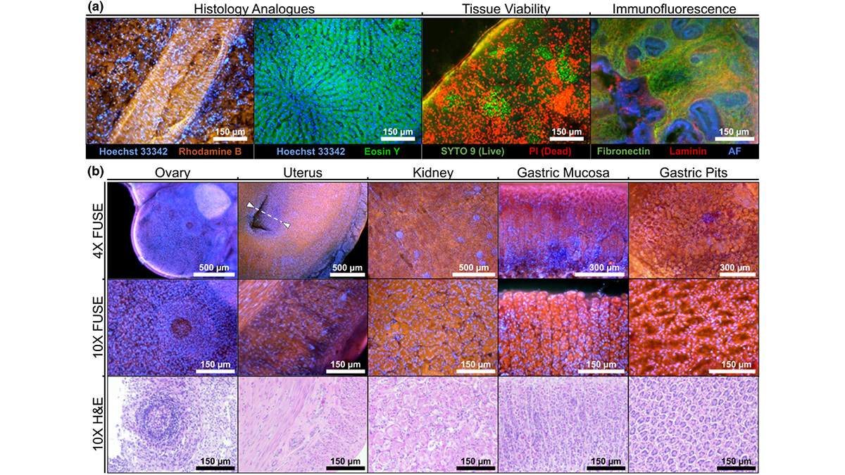 Via #OPG_Optica: Multi-scale tissue fluorescence mapping with fiber optic ultraviolet excitation and generative modeling ow.ly/iC9Z50RPtUc #CellularImaging #ScanningMicroscopy @ASTARsg