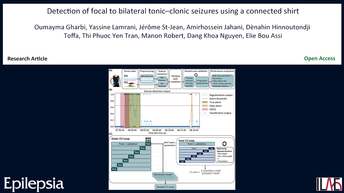 Key point: A machine learning pipeline was developed and showed promise for the detection of FBTCS based on data acquired using a connected shirt. doi.org/10.1111/epi.18… #epilepsy #machinelearning #seizuredetection #wearablebiosensors #ILAE @IlaeWeb @epilepsiajourn @WileyNeuro