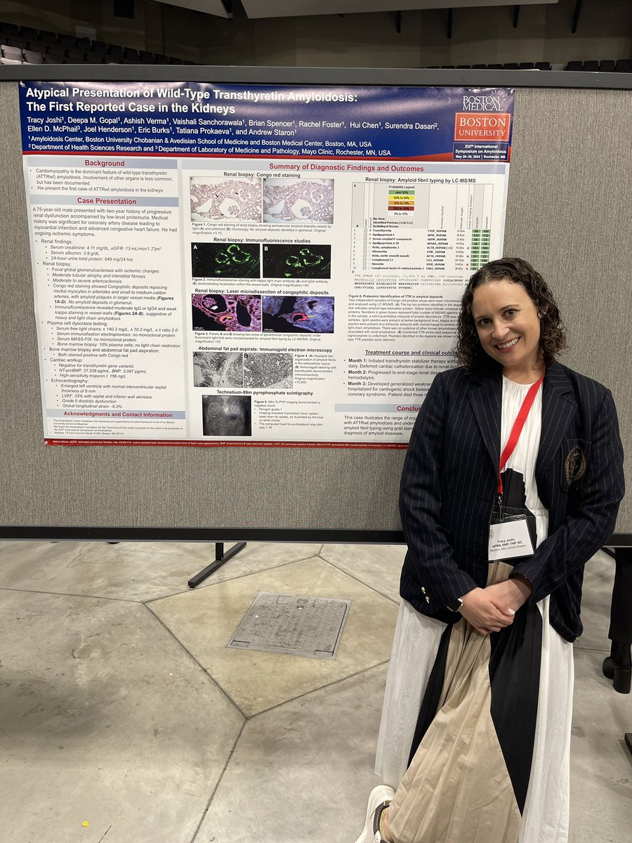 Omar K. Siddiqi, MD, FACC (@omarsiddiqi) on Twitter photo Renal dysfunction in ATTR wild-type #amyloidosis: is it always cardio-renal syndrome and renal congestion? Interesting report of ATTR wild type renal involvement by #tracyjoshi <a href="/dmgopalcardio/">Deepa Gopal</a> <a href="/AshuNephro/">Ashish Verma, MD</a> <a href="/a_staron/">Andrew Staron</a> of <a href="/BU_Amyloidosis/">BU Amyloidosis Center</a> <a href="/BUcards/">BMC|BU Cardiology Fellows</a> <a href="/The_BMC/">Boston Medical Center</a> <a href="/vsanchorawala/">Vaishali Sanchorawala</a> Renal dysfunction in ATTR wild-type #amyloidosis: is it always cardio-renal syndrome and renal congestion? Interesting report of ATTR wild type renal involvement by #tracyjoshi <a href="/dmgopalcardio/">Deepa Gopal</a> <a href="/AshuNephro/">Ashish Verma, MD</a> <a href="/a_staron/">Andrew Staron</a> of <a href="/BU_Amyloidosis/">BU Amyloidosis Center</a> <a href="/BUcards/">BMC|BU Cardiology Fellows</a> <a href="/The_BMC/">Boston Medical Center</a> <a href="/vsanchorawala/">Vaishali Sanchorawala</a>