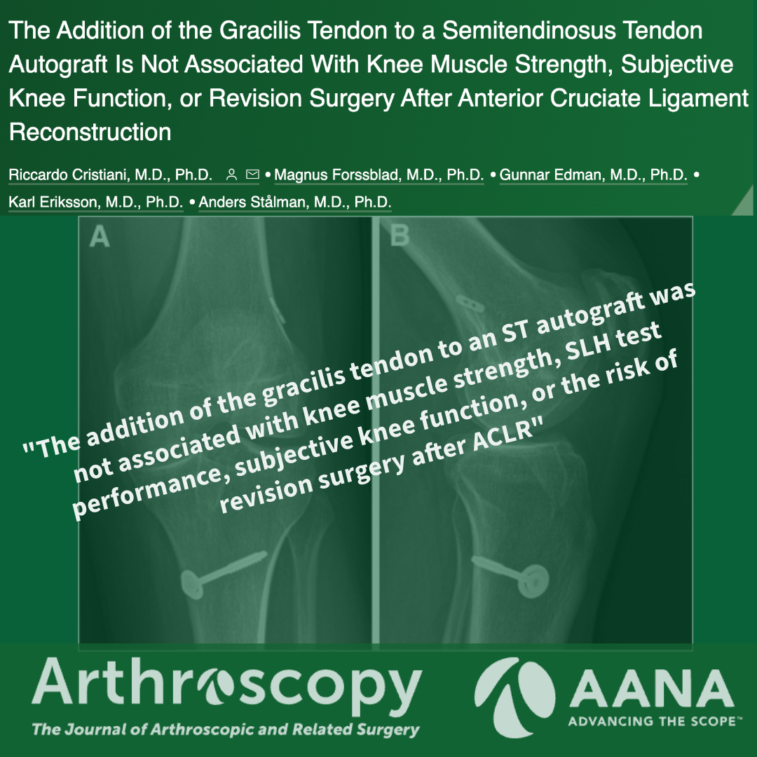 The Addition of the Gracilis Tendon to a Semitendinosus Tendon Autograft Is Not Associated With Knee Muscle Strength, Subjective Knee Function, or Revision Surgery After Anterior Cruciate Ligament Reconstruction #ACL #Hamstring ow.ly/Rxwu50RQ4X5